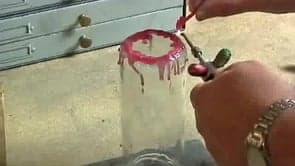 Retrieving Stones from Ultrasonic